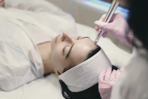 Tratamiento DermaPen en Alicante